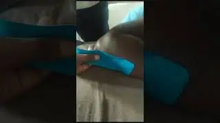 3 т. - тейпирование - 7