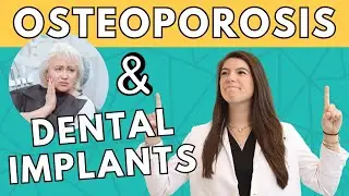 Dental Implants and Osteoporosis | Can I get Dental Implants?