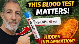 What Your HS-CRP Blood Test REALLY Means (Inflammation Explained)