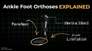 Ankle Foot Orthoses EXPLAINED: Instantly Understand Any AFO Design!