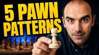 5 Pawn Endgame Patterns to Turn Disasters into Victories