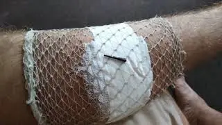 Медицина России!!! Беда!!! Хирурги мудаки!!!