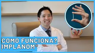 Como Funciona o Implanon? Tudo o que Você Precisa Saber!
