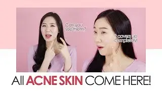 All Acne Skin Come Here ｜Korean Skin Care & Makeup #4