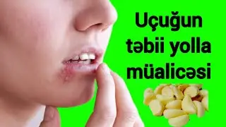 Uçuğu yox eden resept ucuq mazı