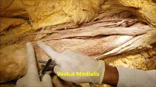 Thigh Anterior Compartment-'Quads' Dissection - Sanjoy Sanyal