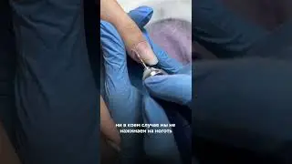 Отслойки в боковых пазухах