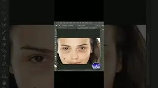 How to Remove Dark Circles Around the Eyes in Photoshop 