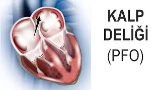 Heart Hole