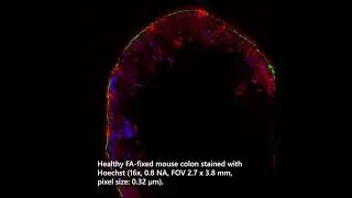 Multi-photon image of mouse colon cross section