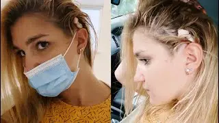 I had SURGERY🩸💉