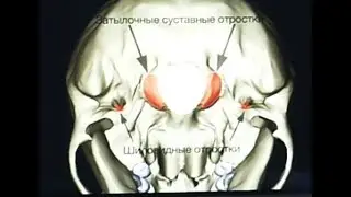 Спас целый. Ставим голову на место. Упражнение улитка.