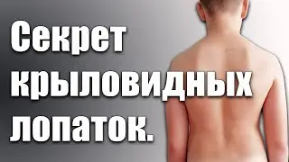 Крыловидные лопатки. Как исправить самостоятельно.