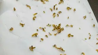 Reaching the deepest point to remove blackheads from the roots