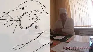 Operations on the chest wall, chest cavity. Part 1. Operat. surg. Akhmadudinov M.G.