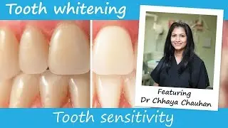 Tooth sensitivity when whitening