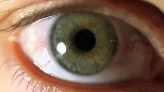 My Eye