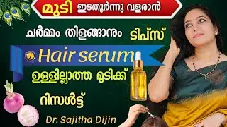 രണ്ടാഴ്ചക്കുള്ളിൽ നെറ്റികയറിയ ഭാഗങ്ങളിൽ മുടിവളർത്താം|Hair spray at home @Ayurcharya