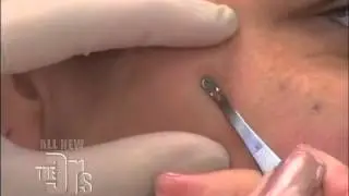The Doctors Naked Skin Lab Medical Course