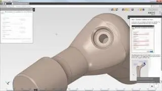 Hip Stem Custom Application