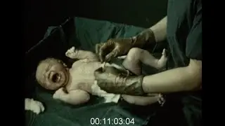 Training Film for Baby Birthing, 1950s - Film 1007312