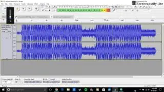 Drake - Skepta Interlude Ear Rape