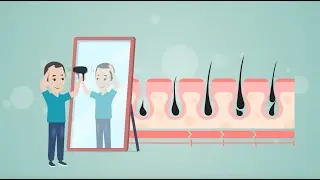 Asmer Life - Saç Simülasyonu | 2D Animasyon video