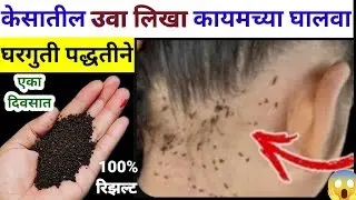 “केसातील उवा आणि लिखा कायमच्या हटवा 🦠🛑 | सोपे आणि नैसर्गिक घरगुती उपाय! 🌿✨”Hair Tips@sushmasalunke