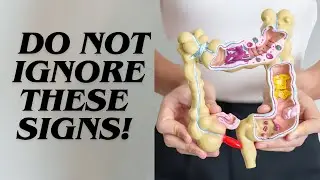 Warning Signs Of Colon Cancer You Should NOT IGNORE