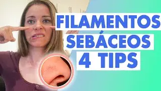 Filamentos sebáceos, solución definitiva
