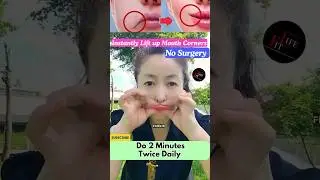 Instantly Lift up Mouth Corners | No surgery #antiaging #yoga #facialyoga #face #facelift #shorts