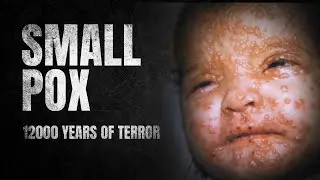 SmallPox - A Virus of the Past & How it Happened | PrepLadder Neet PG