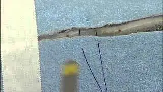 Interrupted Suture Patterns: Horizontal Mattress