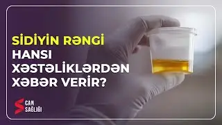Sidiyin rəngi hansı xəstəliklərdən xəbər verir? (11.05.2023) - Medical Meida Live
