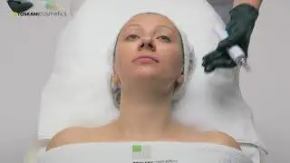 TOSKANI - DERMAPEN zabieg