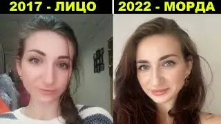 Утиные 💋 губы 💋 после увеличения ботоксом | Проблемы в голове, комплексы, зависть, непринятие себя