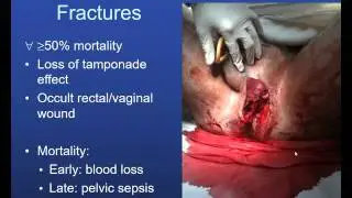Pelvic fractures 3