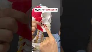 Mystery tooth ache? It could be a muscle! 