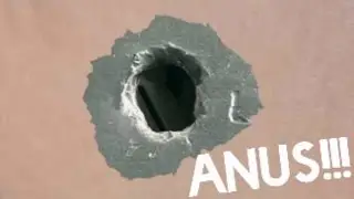 ANUS!!