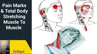 Pain Marks And Total Body Stretching Muscle To Muscle By DrRavi
