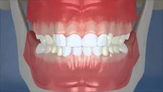 Dental Development - Center View (HD)