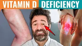 10 Signs You're Vitamin D Deficient (Vitamin D Deficiency Test ✅)
