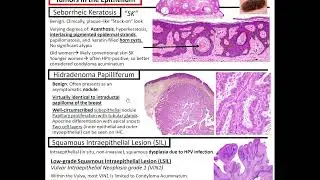 Lesions of the Vulva: Kurt's Notes #pathagonia