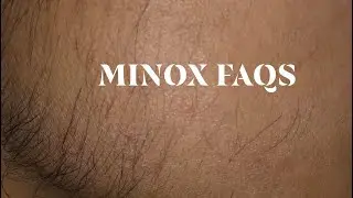 MINOXIDIL FAQS: VACCINATION