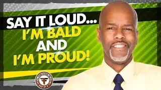 Come on!  Embrace you Baldness.