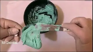Alginate Dental Impression      !!!!!