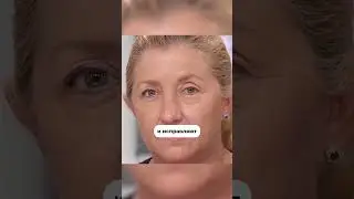 Полоски 9