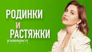 Родинки и растяжки. Moles and stretch marks. 