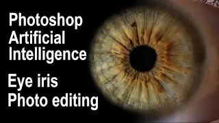 #eye
