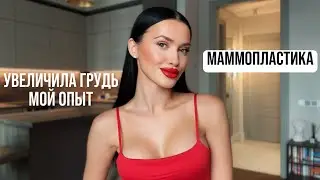 МАММОПЛАСТИКА • увеличила грудь • мой опыт